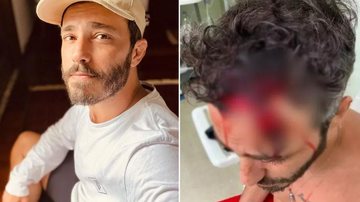 Thiago Rodrigues não aparece para depor após agressões; Polícia investiga o caso - Reprodução/ Instagram