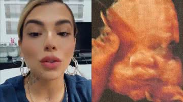 Petra Mattar entra em choque com detalhe inusitado no ultrassom do filho: "Não é meu" - Reprodução/Instagram