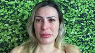 Andressa Urach já teve IST? Ex-Vice Miss Bumbum revelou drama sério na saúde - Reprodução/Instagram