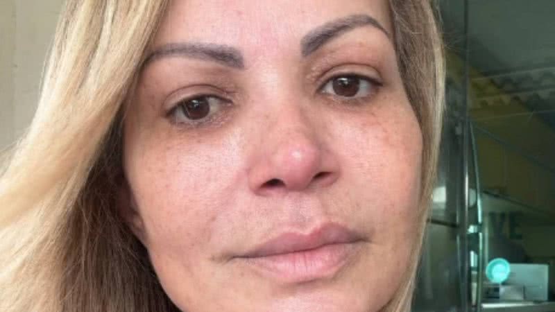Solange Almeida: problema que causou cirurgia de emergência é revelado - Reprodução/Instagram