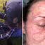 Mulher processa a Polícia após ser algemada com a cara em formigueiro