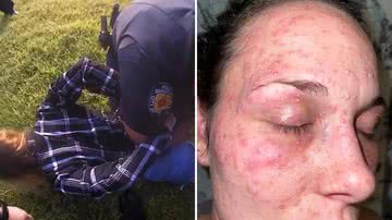 Mulher processa a Polícia após ser algemada com a cara em formigueiro - Reprodução/NY Post