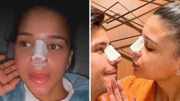 Jakelyne Oliveira conta que ela e Mariano retiraram pedaço da costela para inserir no nariz: "É necessário" - Reprodução/Instagram