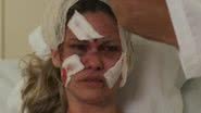 No hospital, a vilã ficará fora de si ao ver a situação do seu rosto depois do grave acidente; confira! - Reprodução/TV Globo