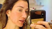 A blogueira mostrou rosto depois de passar por uma técnica de prevenção do melasma - Reprodução/Instagram