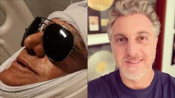 Amin Khader fica insatisfeito com nariz após rinoplastia: "Parece do Luciano Huck" - Reprodução/Instagram