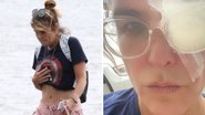 Cristiana Oliveira assusta fãs ao mostrar acidente durante caminhada ao ar livre: "Um passeio inofensivo" - Reprodução/Instagram