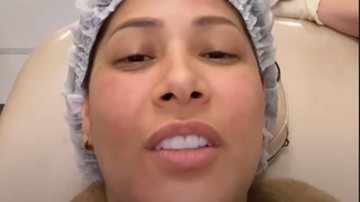 De cara lavada, Simaria passa por procedimento no rosto: "Cansei de tanta feiura" - Reprodução/ Instagram