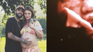 Esposa de Pedro Scooby mostra rostinho da filha em ultrassom e baba: "Gostosura" - Reprodução/Instagram