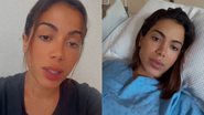 Estado de saúde de Anitta - Reprodução/Instagram