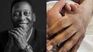 Irmã de Pelé abre o coração e revela últimas palavras do irmão antes de falecer: "Netos" - Reprodução/ Instagram