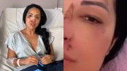 Daniele Bezerra mostrou como está seu nariz após uma briga de rua - Reprodução/Instagram
