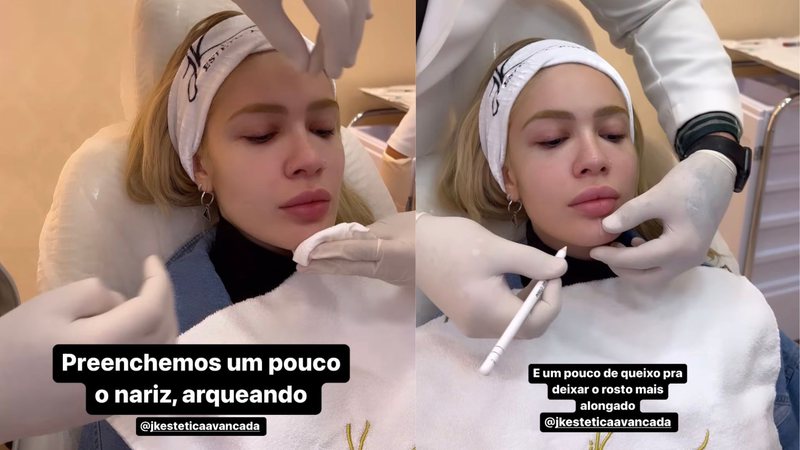 Karoline Lima faz procedimentos estéticos e tem resultados incríveis - Reprodução/Instagram
