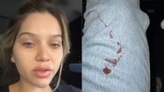 Filha de Leandro sofre fratura e surge com roupa coberta de sangue - Instagram