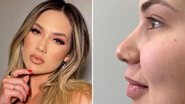 A influenciadora Virgínia Fonseca faz procedimento no nariz e mostra antes e depois: "Ficou perfeito" - Reprodução/Instagram