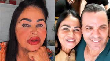 Maria Costa: conheça a mãe de Eduardo Costa que polemizou com procedimentos faciais - Reprodução/Instagram