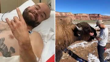 Homem sofre corte abdominal de 20 centímetros após tentar fazer carinho em bisão - Reprodução/Instagram