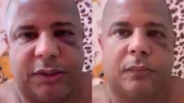 Coagido, Marcelinho Carioca aparece com olho roxo em vídeo: "No cativeiro" - Reprodução/ Instagram