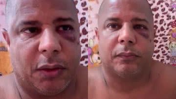 Cantor sai em defesa de sequestrador de Marcelinho Carioca: "Apanhou pouco" - Reprodução/ Instagram