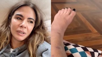 Imagens fortes! Luciana Gimenez surpreende ao mostrar cicatriz na perna desde o grave acidente: "Um mês" - Reprodução/ Instagram