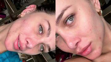 Flávia Pavanelli dispensa maquiagem e surge com rosto coberto de acne: “Pele real” - Instagram