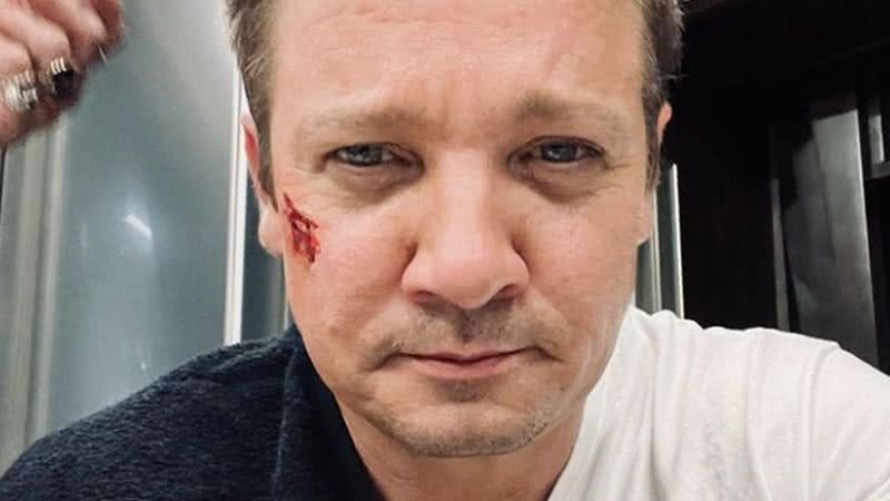 Ator de 'Vingadores', Jeremy Renner sofre acidente e fica em estado grave - Reprodução/Instagram