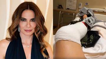 Luciana Gimenez inicia tratamento após grave acidente na neve - Instagram