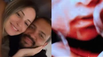 Ex-BBB Projota encanta fãs ao mostrar rostinho do bebê no ultrassom: "Clonaram" - Reprodução/ Instagram