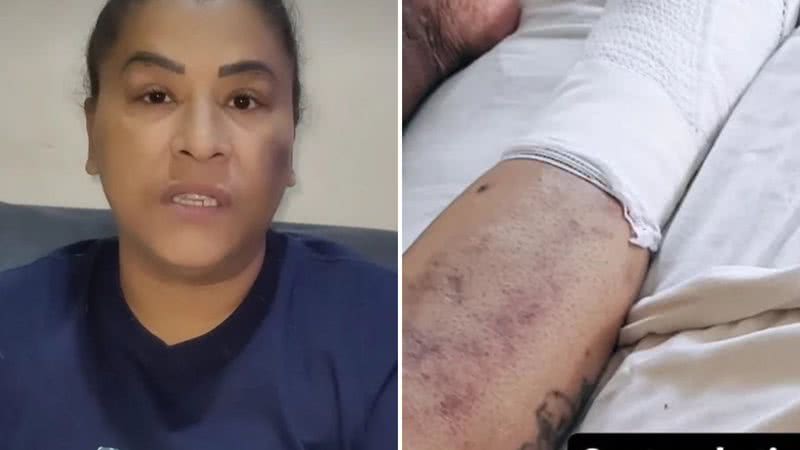 O que aconteceu com MC Katia? Funkeira amputo o pé após diagnóstico grave - Reprodução/Instagram