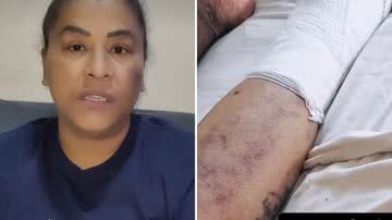 O que aconteceu com MC Katia? Funkeira amputo o pé após diagnóstico grave - Reprodução/Instagram