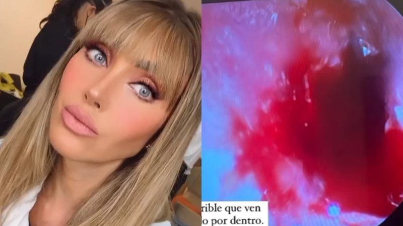 Anahí, do RBD, sofre acidente grave e pode perder a audição - Reprodução/Instagram