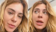 A atriz Carolina Dieckmann esclarece inchaço facial e nega harmonização: "Acham que enlouqueci" - Reprodução/Instagram