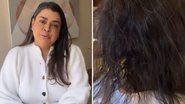 Preta Gil tira o aplique e mostra cabelo após a quimioterapia: "Caiu muito" - Reprodução/Instagram