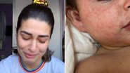 Vivian Amorim se desespera após doença da filha se espalhar: "Coração pequeno" - Reprodução/ Instagram