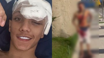 Influenciador baleado na cabeça sobrevive e surge sorrindo - Reprodução/Instagram