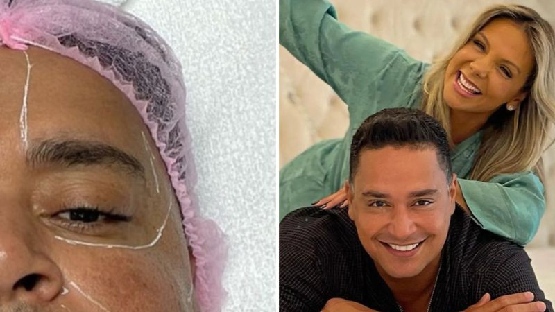 O cantor Xanddy faz procedimento no rosto a pedido da esposa, Carla Perez: "Topei" - Reprodução/Instagram