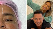 O cantor Xanddy faz procedimento no rosto a pedido da esposa, Carla Perez: "Topei" - Reprodução/Instagram