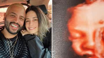 Separados, ex-esposa de Projota mostra rostinho do filho em ultrassom: "Mamãe que lute" - Reprodução/Instagram