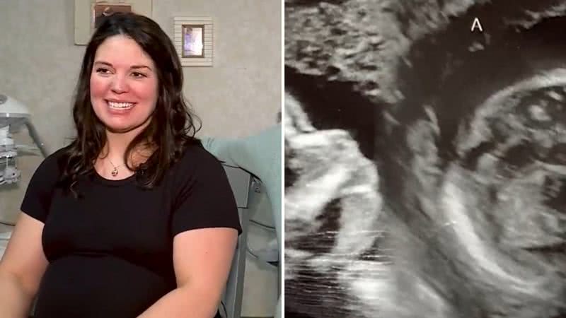 Com dois úteros, mulher descobre gravidez dupla em evento raríssimo - Reprodução/WVTM13