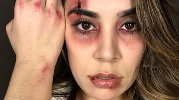 Naiara Azevedo já surgiu 'machucada' para denunciar violência doméstica - Reprodução/Instagram