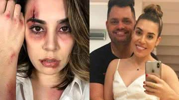 Naiara Azevedo teve bens roubados pelo ex-marido: "Estão no nome dele" - Reprodução/ Instagram