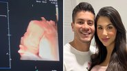O ator Arthur Aguiar e a empresária Jheny Santucci surgem juntos pela primeira vez após separação e mostram ultrassom do primeiro filho: "Nosso bebê" - Reprodução/Instagram