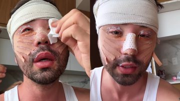 Rico Melquiades desabafou após ser criticado por cirurgias que fez em seu rosto - Reprodução/Instagram