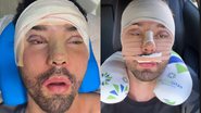 Rico Melquiades passou por novas cirurgias no rosto - Reprodução/Instagram
