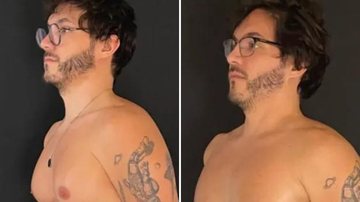 Impressionante! 20 dias depois, ex-BBB Eliezer mostra resultado da cirurgia de redução de mamas - Reprodução/ Instagram