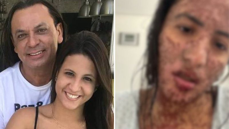 Antes do divórcio, mulher de Frank Aguiar teve doença rara: "Achei que ia morrer" - Reprodução/Instagram