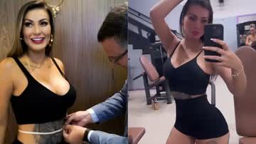 Andressa Urach fará nova cirurgia - Reprodução/ Instagram