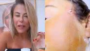 Mulher de Leonardo faz 'cirurgia' no rosto e resultado choca: "Tava caída" - Reprodução/Instagram
