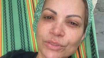 Solange Almeida passa por cirurgia às pressas e cancela agenda - Reprodução/Instagram