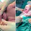 Bebê nasce com 'dentes' no MS e surpreende família